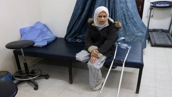 بين جراح البتر و”التيه” القانوني.. آلاف الجرحى من غزة يواجهون مستقبلاً مجهولاً في القاهرة