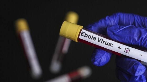 إسرائيل تعلن تسجيل أول حالة اشتباه بالإصابة بفيروس “إيبولا”