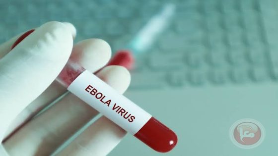فرنسا تعلن تسجيل أول حالة إصابة محلية بفيروس إيبولا